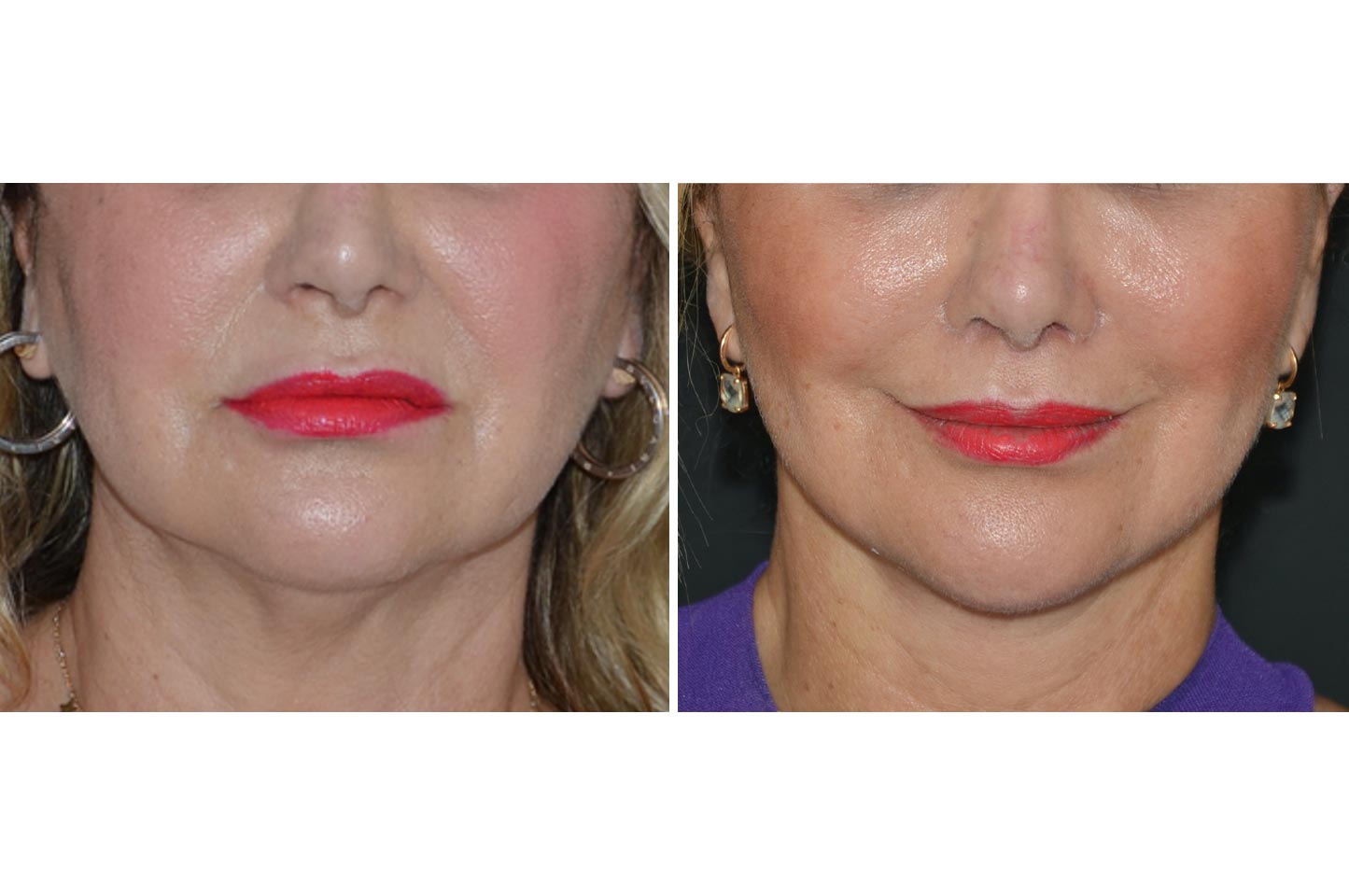 face-neck-a1.jpg